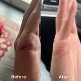 Eczema - Oat Cream 150ml